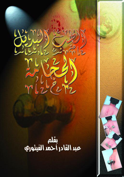 الطب البديل -- الحجامة الطب البديل -- الحجامة
